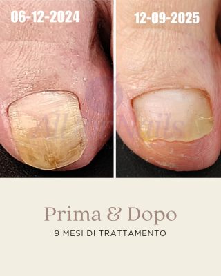 ibx_famousnamesitalia_ladybird_1761822586_3754762330493100440_3247212373