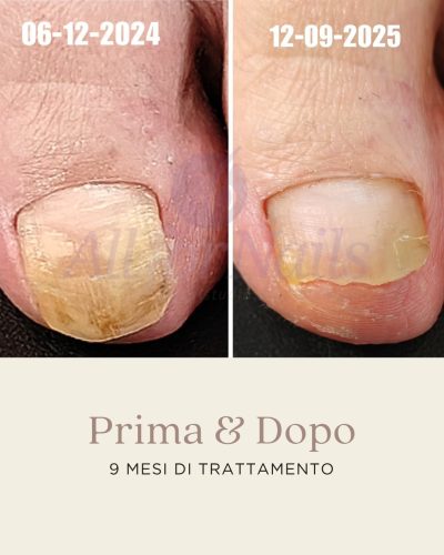 ibx_famousnamesitalia_ladybird_1761822586_3754762330493100440_3247212373